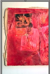 Cesarean Section, 1987